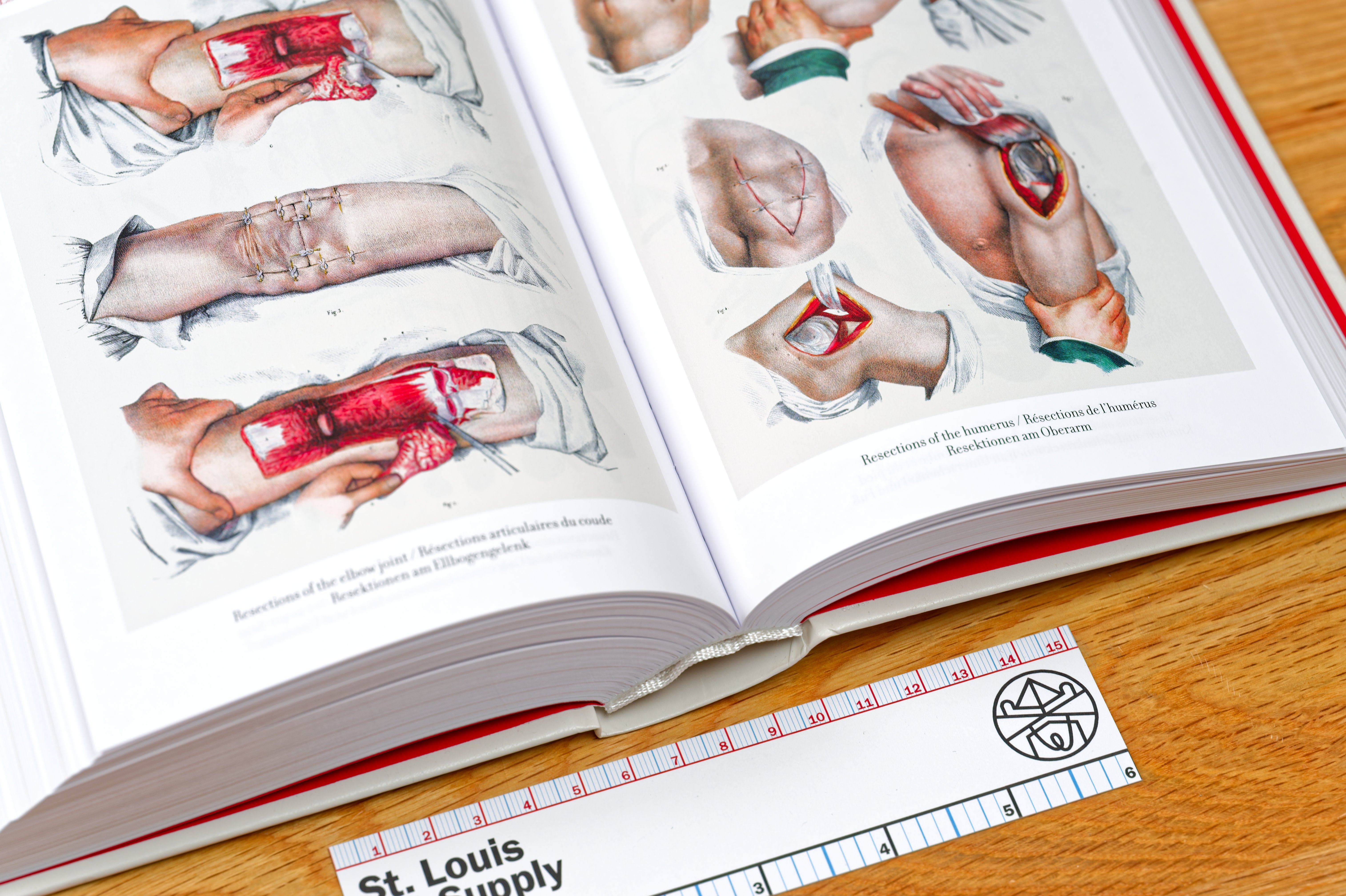 Atlas of Human Anatomy and Surgery (Bibliotheca Universalis) – St